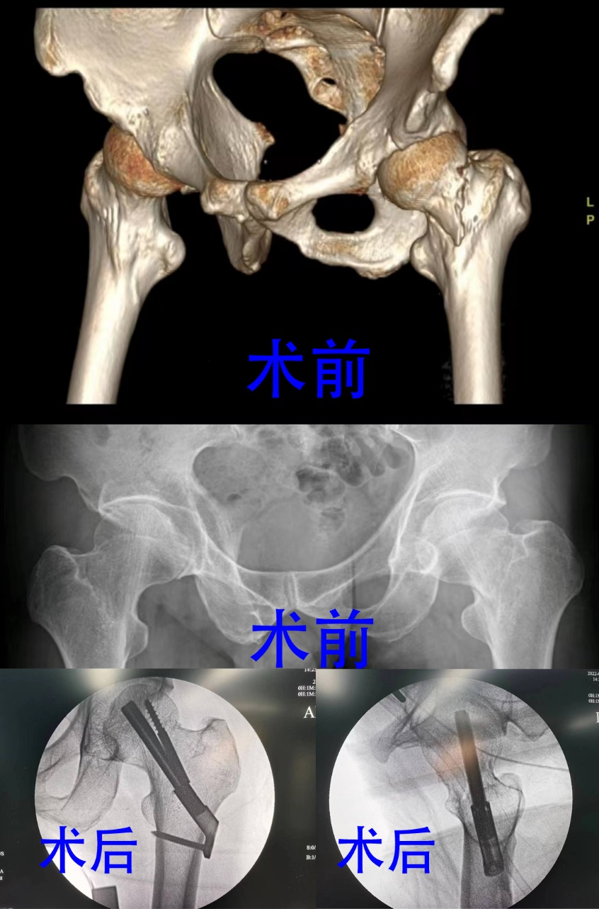 菏澤醫(yī)專附屬醫(yī)院