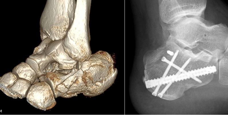 菏澤醫(yī)專附屬醫(yī)院