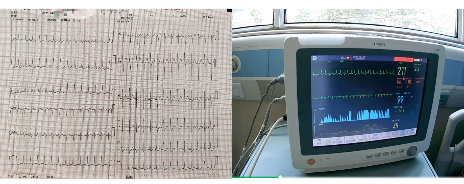 菏澤醫(yī)專附屬醫(yī)院